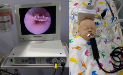 Ларингоскоп для новорожденных